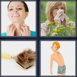 4 Pics 1 Word 7 Letters Allergy